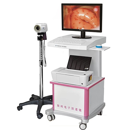 colposcopy